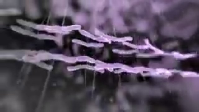 Heart Failure Made Simple: Early Signs, NYHA Classification & Treatment Algorithm